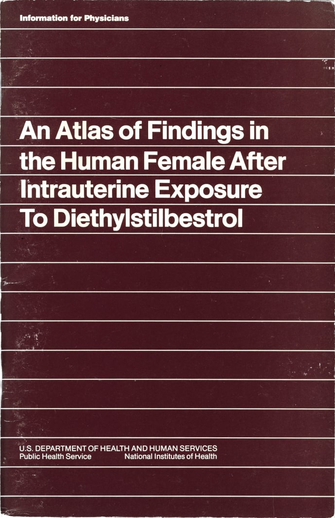 <p>An Atlas of Finding in the Female After Intrauterine Exposure To Diethylstilbestrol - Information for Physicians - U.S. Department of health and human services - 1983.</p>
