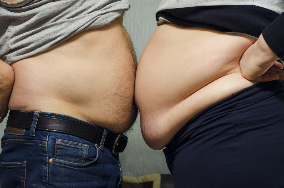 Photo représentant un couple obèse, illustrant l'action obésogène d