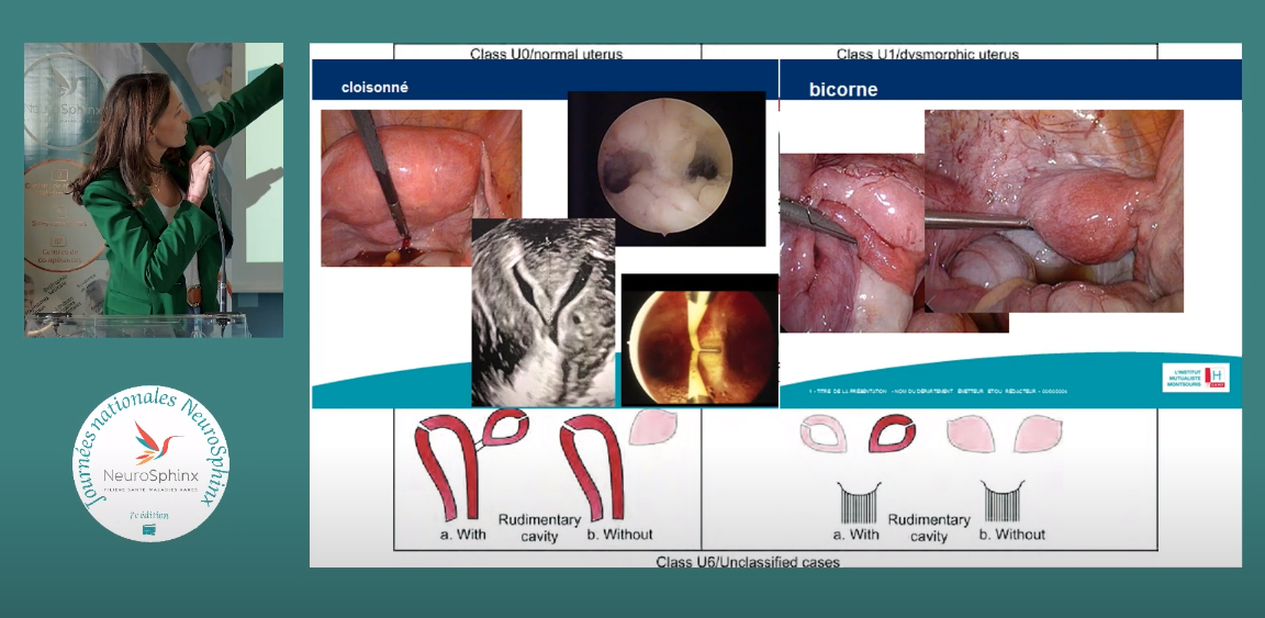 D.E.S is it a été conviée aux journées nationales de la Filière santé NeuroSphinx qui se sont déroulées à l'Institut Imagine les 2 et 3  mars 2023