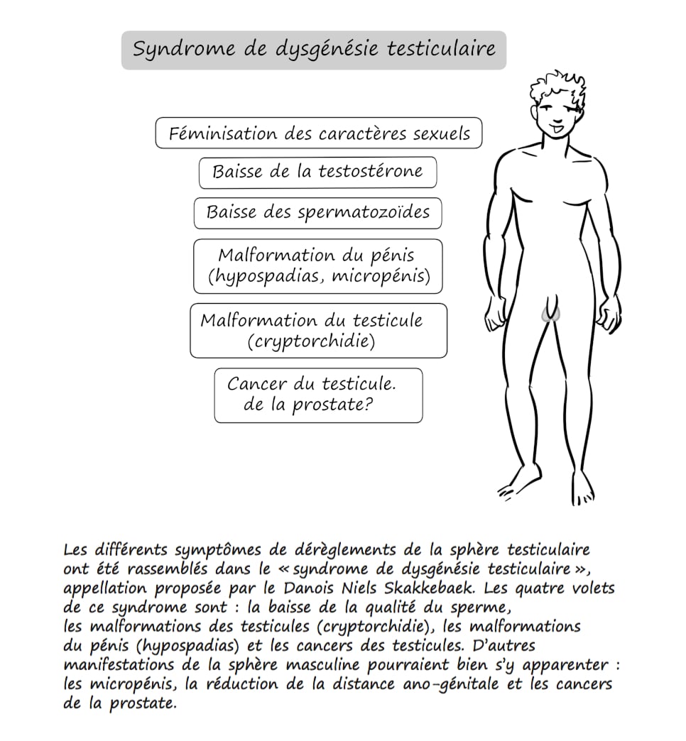 Syndrome de dysgénésie testiculaire - Le grand désordre hormonal - Illustration de Laurent Lalo
